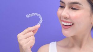 Read more about the article Benefits of Invisible Braces