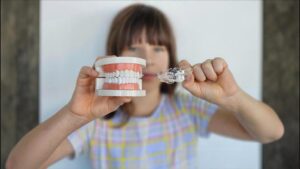 Read more about the article Science Behind Invisible Braces for Teeth Alignment: Comfort, Efficiency, and Style